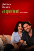 À coeur ouvert | ShotOnWhat?